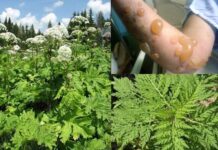 Вінничан запрошують на толоку знищувати небезпечну рослину борщовик