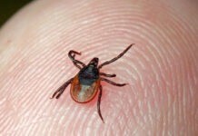 У Вінниці можна зробити аналізи на бореліоз та кліщовий енцефаліт