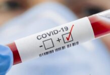 На Вінниччині зареєстровано 330 нових випадків COVID-19