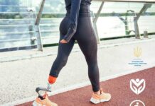 Вінничани можуть звертатись на довідкову лінію з питань протезування кінцівок