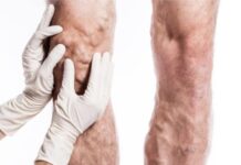 Тромби не болять, але загрожують здоров’ю та життю Тромби не болять