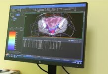 У вінницькому онкоцентрі пацієнти зможуть безкоштовно лікуватися променевою терапією лінійний прискорювач