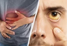 У Вінниці розпочалася екстренна вакцинація від гепатиту А гепатит А