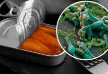 Небезпека ботулізму влітку: Як уникнути захворювання