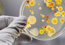 Гострі кишкові інфекції: на Вінниччині фіксують нестабільну епідситуацію