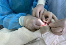 Вінницькі хірурги успішно видалили пухлину з очей дитини