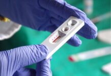 Вінничани можуть пройти безкоштовне тестування на ВІЛ та гепатит С