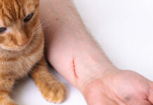 Вінницькі медики б’ють на сполох: 36 дітей постраждали від укусів тварин з початку року