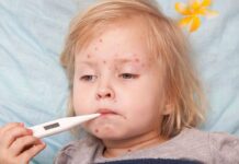 Захворюваність на кір серед дітей на Вінниччині досягла рекорду за рік