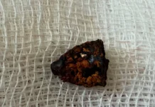 З тіла Героя з Вінниччини Дмитра Фінашина вилучили кулю