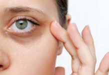 Як позбутися темних кіл під очима: поради для свіжого погляду