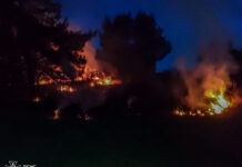 На Вінниччині під час пожежі постраждала дитина