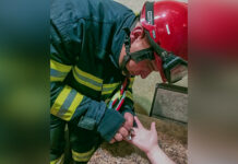 У Вінниці рятувальники зняли обручку, яка ледь не стала пасткою для жінки