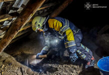 На Вінниччині через пожежу в гаражі травмувалася жінка