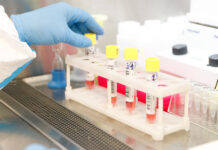 У Вінницькій області зменшилася кількість хворих на ГРВІ та грип